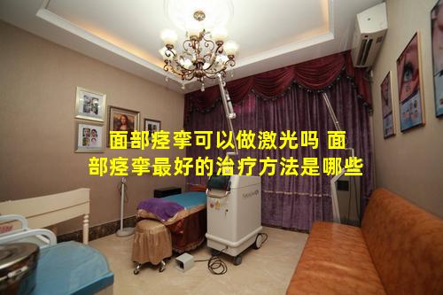 面部痉挛可以做激光吗 面部痉挛最好的治疗方法是哪些